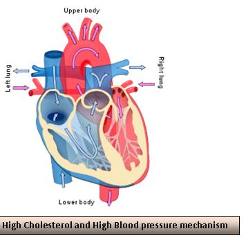 cholesterol and  high blood preasure