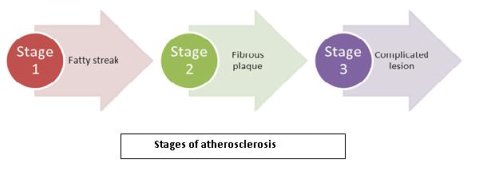 stages of atheroslerosis